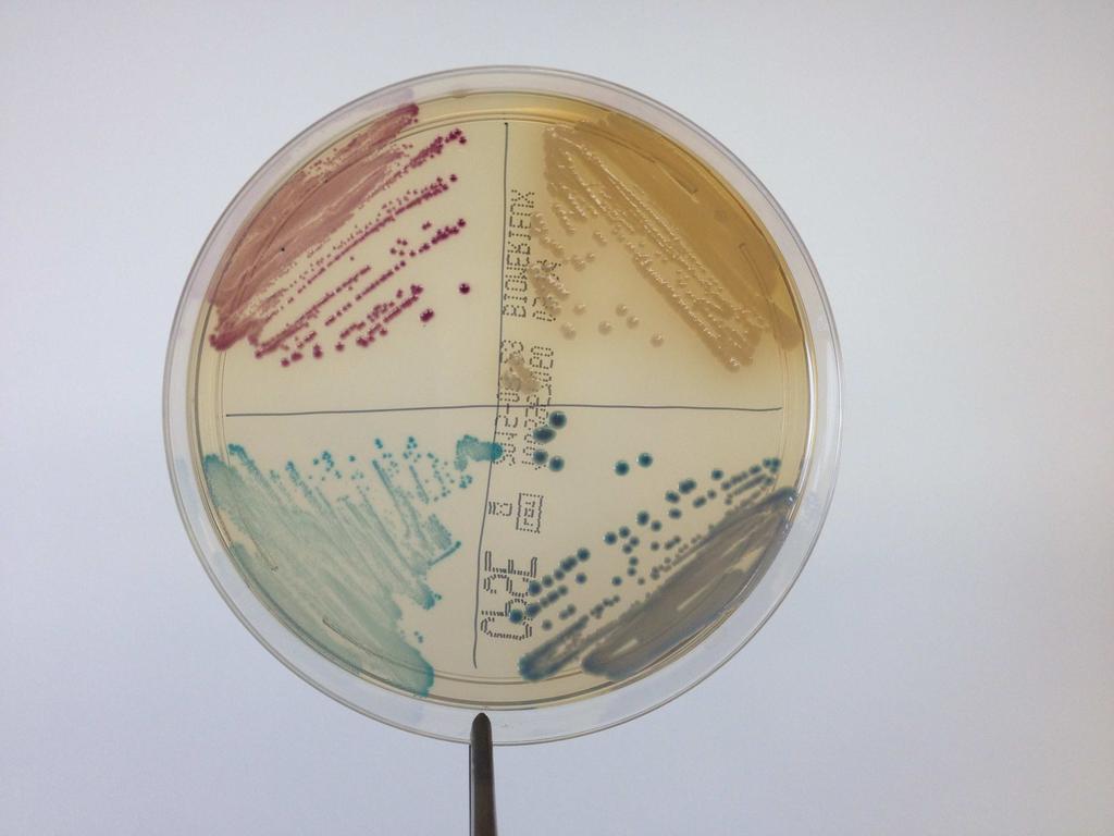 Ilustración 1. Aspecto de las colonias de distintos microorganismos en medio CPS-3. Arriba a la izquierda: E. coli; arriba a la derecha: P. mirabilis; abajo a la izquierda: E.
