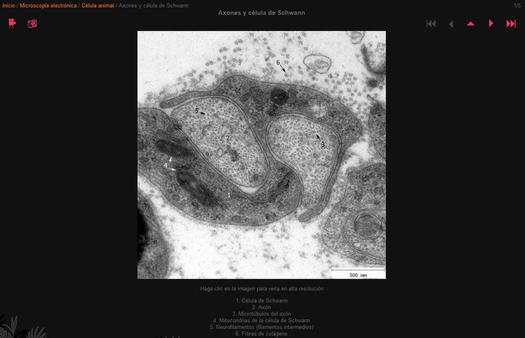 IMAGEN 3: Ejemplo de la visualización de una de las imágenes de microscopía electrónica una vez rotulada, clasificada e incluida en