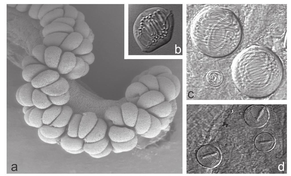 Figura 1. a: tentáculo del sifonóforo Physalia physalis (microscopia electrónica) mostrando las baterías de nematocistos. b, c,d: distintos tipos de nematocistos hallados en esta especie.