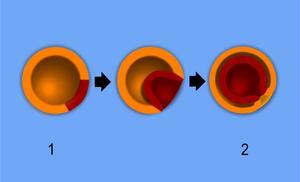 La Gástrula -La fase de gástrula está caracterizada por una dramática reestructuración denominada gastrulación. -Cuando la gastrulación se ha completado, el embrión se convierte una neurula.