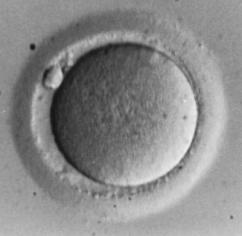 0099 RIF ( 3 IVF failures ; < 40 yrs) Blastocyst PGS P-value No. of cycles 43 48 ---- Mean Age (SD) 35.