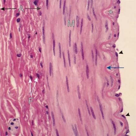 ? Transverse section of a medium-sized artery. The intima shows the endothelium (arrowheads) separated from the acidophilic internal elastic lamella (blue arrow) by a layer of connective tissue (*).