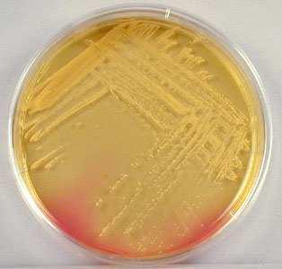 Bacterias zoonóticas transmitidas por alimentos: Salmonella