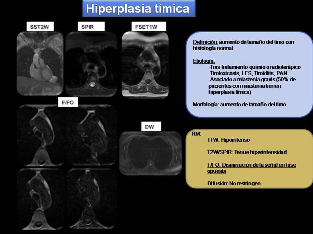 Fig. 10: Hiperplasia
