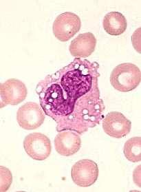 Monocitos en la sangre