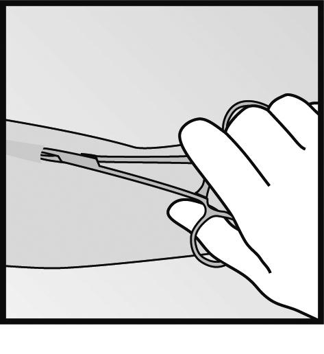la incisión (Figura 15). Gire la pinza hacia su otra mano (Figura 16).