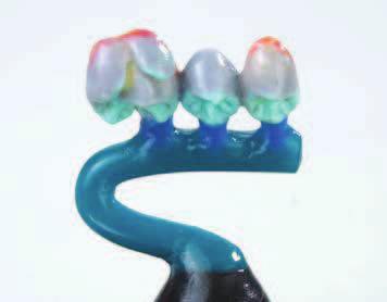 Las formas de los dientes han sido reducidas proporcionalmente. Para modelados de alta estabilidad dimensional. Trabajos sin tensiones.