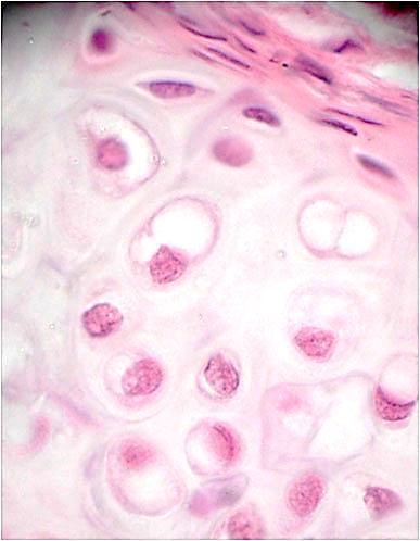 Tipos celulares característicos Fibrocito