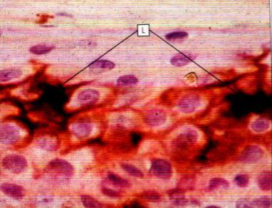 Células de Langerhans o Dendríticas