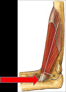 TENDONES Los tendones, no son más que tejido conectivo denso cuya