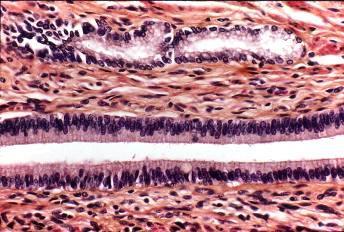 Funciones del tejido epitelial El epitelio es un tejido avascular que recubre: i) superficies externas del cuerpo ii) cavidades internas cerradas iii) tubos que comunican con el
