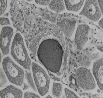 BOLETÍN DEL PRONALSA Vibriosis También se le conoce como necrosis bacilar o necrosis larval.
