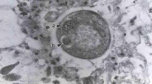 virginica y de otras especies de moluscos bivalvos. Experimentalmente se ha infectado a Crassostrea gigas, especie que es más resistente a este parásito.