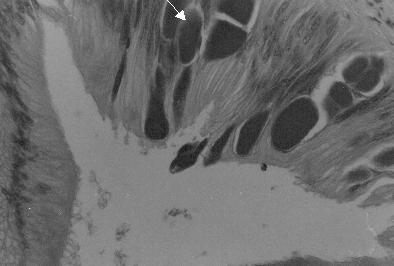 DICIEMBRE 2001 Síndrome de Deshidratación Este síndrome es más evidente en el abulón negro Haliotis cracherodii, aunque también se presenta en el abulón azul, H. fulgens, abulón amarillo, H.