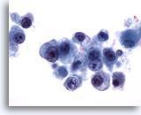 parecen linfocitos pero muestran núcleos excéntricos.
