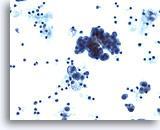 Las células muestras citoplasma granular y
