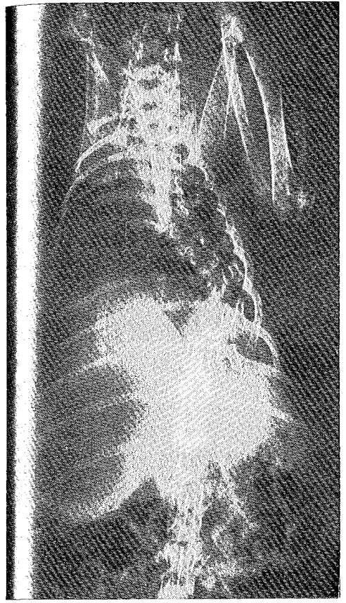 Figura 8. Radiografía AP de un conejo al que se le realizó 30 días antes costotransversectomía a tres niveles del lado derecho.