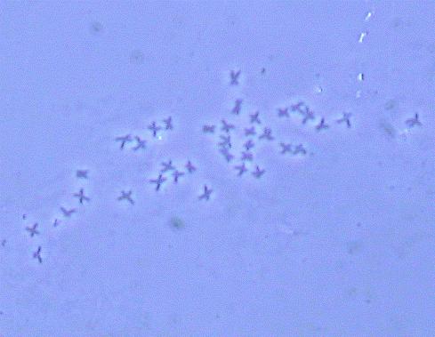 MATERIALES Y MÉTODOS Obtención de cromosomas Imágenes cromosómicas fueron obtenidas desde placas metafásicas en larvas de abulón rojo del Pacifico, Haliotis rufescens 24 hrs. post-fertilización.