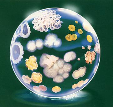 CONOCIMIENTOS Sobre microorganismos relacionados con el problema
