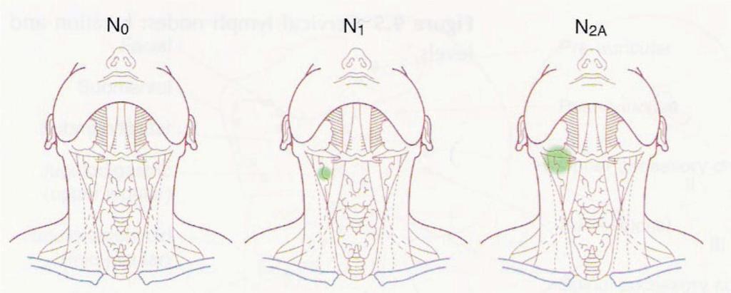 No hay ganglios Ganglio ipsilateral único < 3 cm Ganglio ipsilateral único > 3 cm, < 6 cm Ganglio ipsilateral múltiple < 6 cm