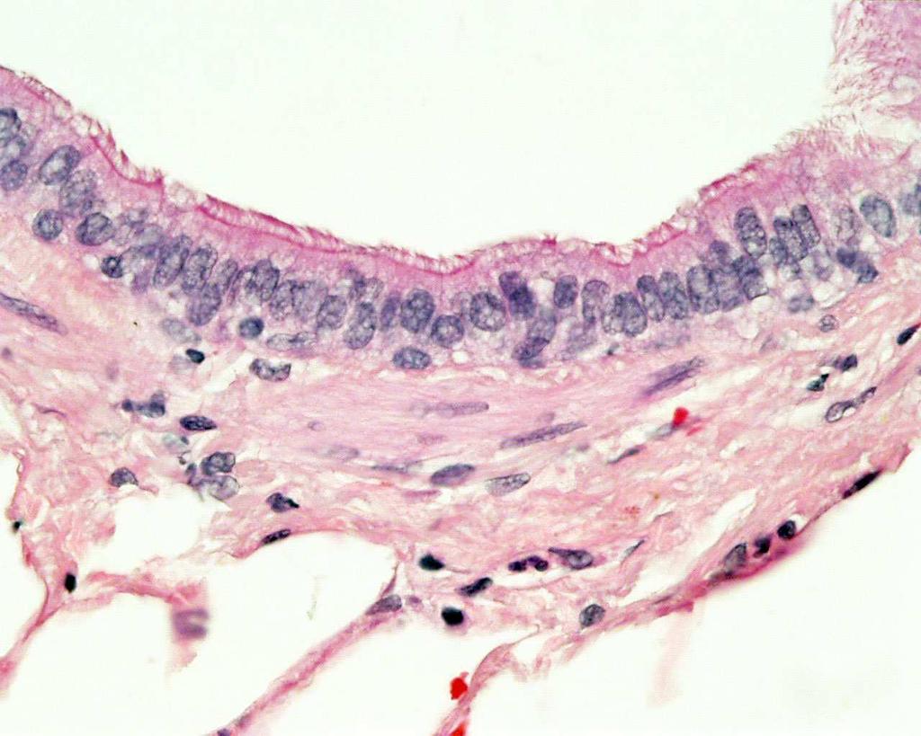 Sinusoides venosos Mucosa