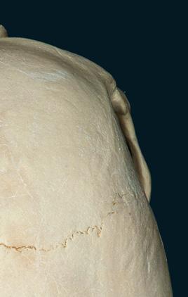 Cráneo Este pliego muestra la norma superior, o cara superior del