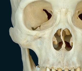 Los huesos craneales poseen diferentes funciones importantes, entre las que incluyen, la de proteger el delicado tejido del encéfalo, fijar el aparato vestibular del oído interno en el espacio