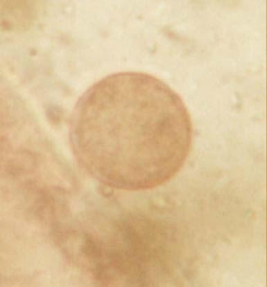 Fotografía 4: Microfotografía de huevo tipo Taenia en Método de