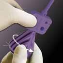 Opcional: si se requiere control adicional del tendón, pase un FiberWire Nº2 alrededor (o a través) del tendón y cargue esos extremos de la sutura por los orificios en la punta bifurcada.