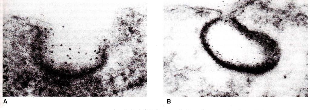 Lípidos: Lipoproteínas de transporte Micrografías electrónicas que muestran la endocitosis de LDL mediada por receptor en los fibroblastos
