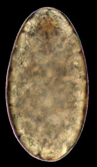 Figura 50-5. Huevo de Fasciola gigantica procedente de una muestra fecal de un bovino de Bobo Dioulasso, en Burkina Faso.