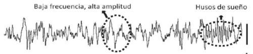 La actividad sigma (9-15 Hz) corresponde a los husos de sueño característicos del snrem los cuales son generados a nivel del loop tálamo-cortical.
