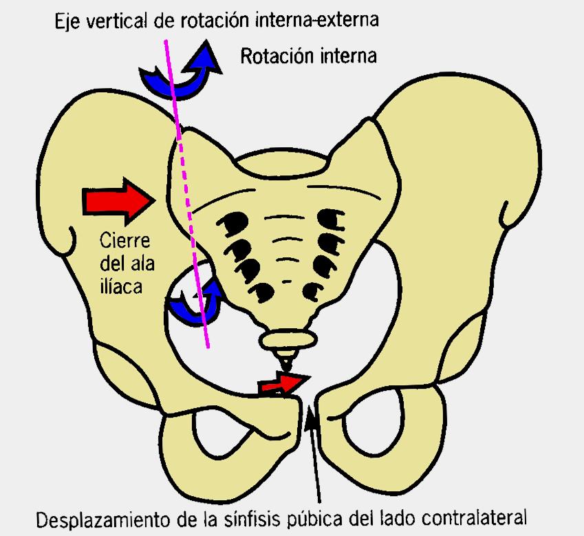 la articulación sacroiliaca; y el otro eje es anteroposterior que también pasa por S2 o istmo articular.
