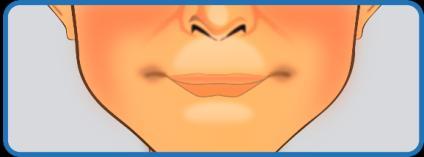 NOMENCLATURA CARACTERÍSTICAS REPRESENTACIÓN GRÁFICA EF-CI-AN El usuario arruga la nariz. EF-CI-LLS El usuario realiza un levantamiento del labio superior.