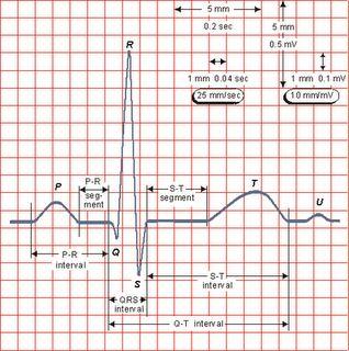 En el cuerpo de la persona examinada (paciente) se ubican electrodos en sitios específicos de la superficie corporal que permiten registrar las diferencias de potencial eléctrico cardíaco desde