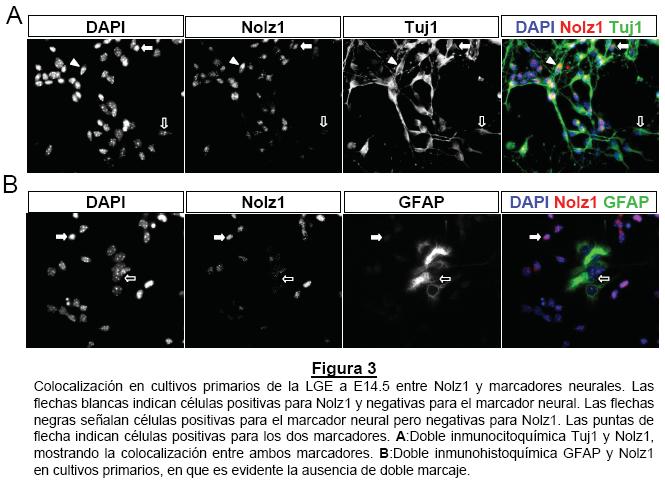 Para caracterizar qué tipo de célula expresa Nolz1 analizamos si en cultivos primarios de la LGE de embriones de 14 días de gestación se conservaba la expresión de Nolz1.