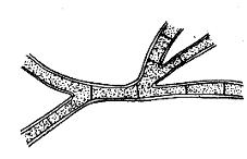 Morfología del talo Los hongos tiene 3 tipos de hifas, Septadas