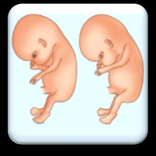 Revista Clínica de la Escuela de Medicina UCR HSJD Año 2014 Vol 4 No III embarazos. Este se considera como una condición patológica, principalmente por la sobrecarga que produce.