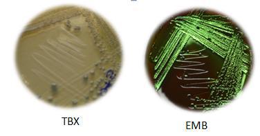 Figura 5.- Crecimiento característico de las E. coli en diferentes agares. Determinación de grupos filogenéticos de E. coli Se analizaron 384 cepas presuntivas de E.