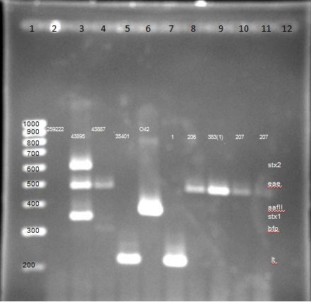sólo una muestra (1/345; 0.29%) resultó positiva para el gen lt, es decir que pertenece al patotipo de E. coli enterotoxigénica (ETEC).