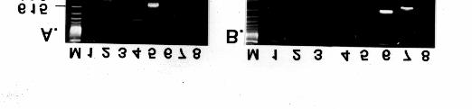 RT-PCR P types