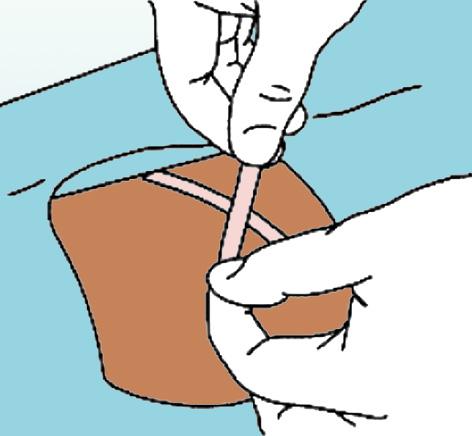 Verifique el efecto de la anestesia antes de hacer una incisión en la piel.