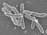 4. TRANSPORTE DE VACUNA POR BACTERIAS Bacterias que repliquen dentro células.