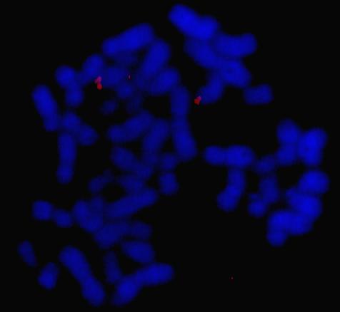 Así, estas estructuras juegan un papel principal en el mantenimiento de la estabilidad cromosómica.