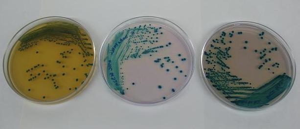 Agar cromogénico Enterobacter sakazakii: