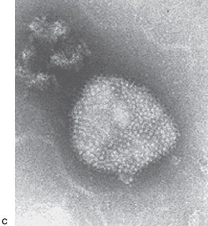C: Un arenavirus, virus de Tacaribe (Arenaviridae).