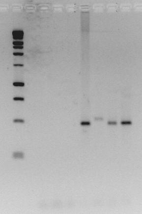 78 En esta PCR se incluyeron los siguientes controles: control de los reactivos, agua en lugar de ADN (canal 3), control negativo, ADN extraído de células DH82 no infectadas (canal 4); control