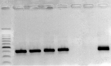82 2, 3, 4 y 5); después que se llevó a cabo la PCR hubo amplificación en el control positivo y en las muestras, lo que se evidenció como bandas de aproximadamente 390 pb en el gel utilizado para la