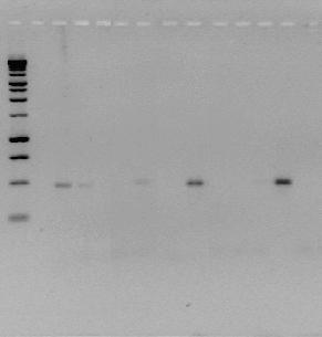 83 1 2 3 4 5 6 7 8 9 10 11 12 13 14 pb 1000 750 500 490 pb 250 Figura 37. Electroforesis en gel de agarosa de los productos de la primera PCR de los cultivos primarios infectados (cebadores ECC/ECB).