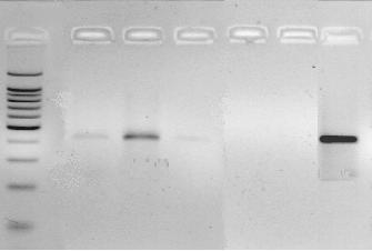 84 1 2 3 4 5 6 7 pb 500 400 300 400 pb 200 100 Figura 38. Electroforesis en gel de agarosa de los productos de la segunda PCR con los cultivos primarios (cebadores ECA/HE3).